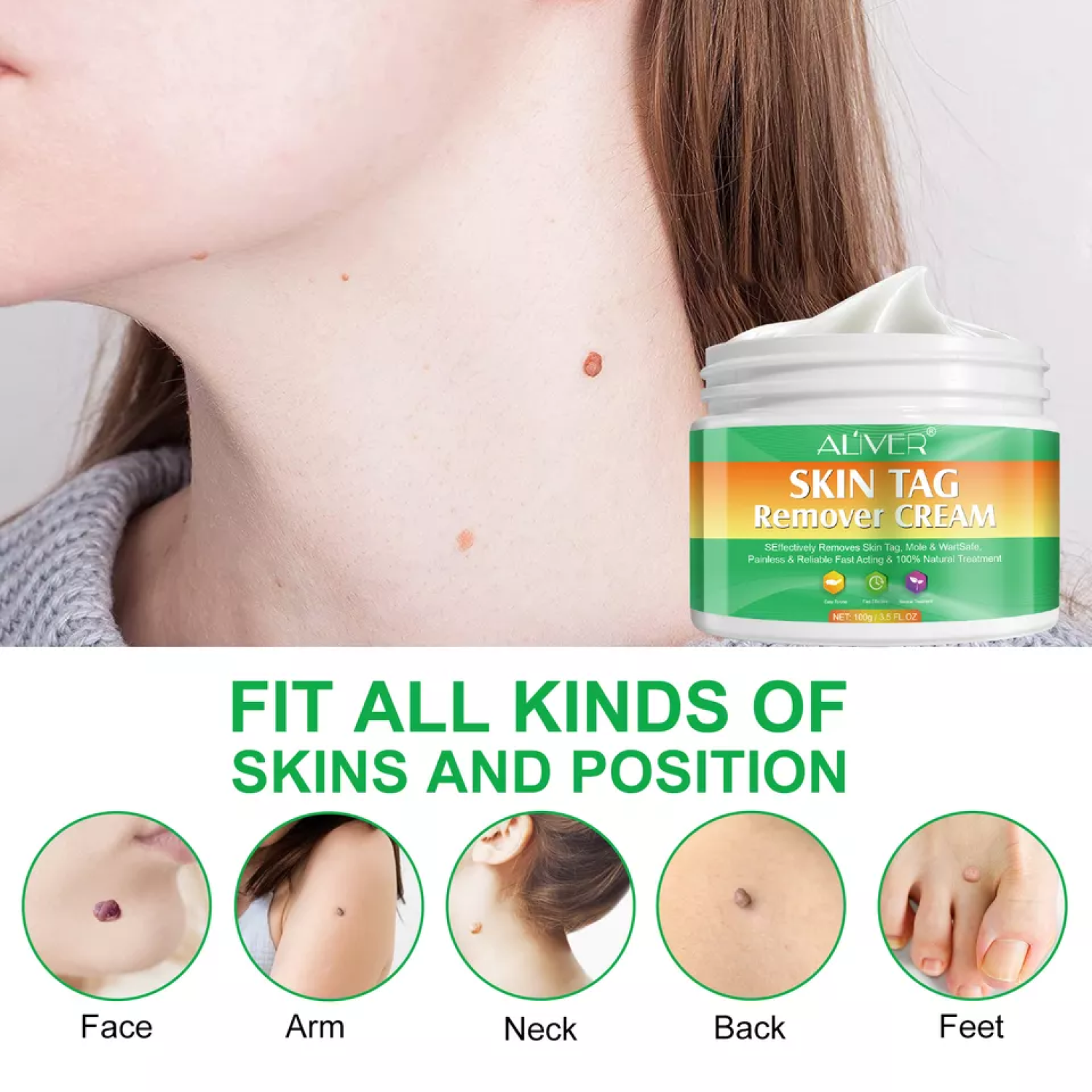ALIVER Skin Tag, Acne & Wart Remover Cream, 100g