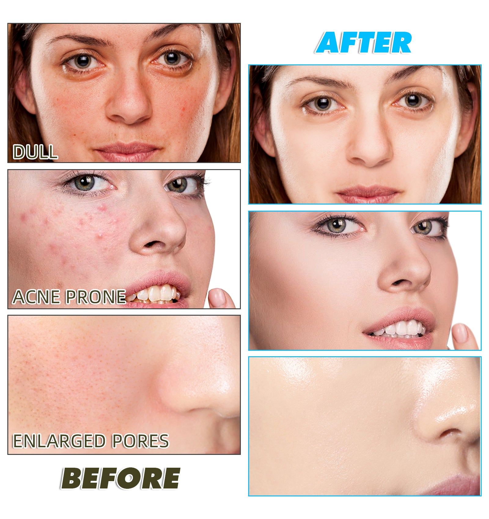 IKZEE Kojic Acid & Turmeric Cleansing Pads, 60pcs