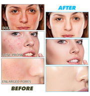 IKZEE Kojic Acid & Turmeric Cleansing Pads, 60pcs