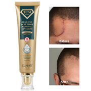 ELAIMEI TCM Scar And Acne Mark Removal Gel Cream, 30g