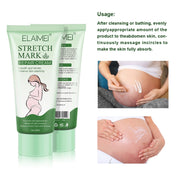 ELAIMEI Anti Stretch Mark Cream, 60ml