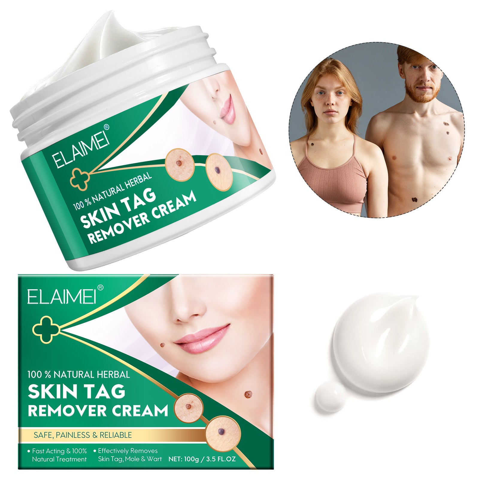ELAIMEI Natural Herbal Skin Tag Remover Cream, 100g