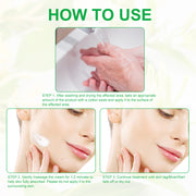 ALIVER Body Skin Tag & Wart Remover Ointment, 20g