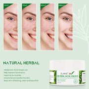 ELAIMEI Herbal Acne Treatment Cream, 50g
