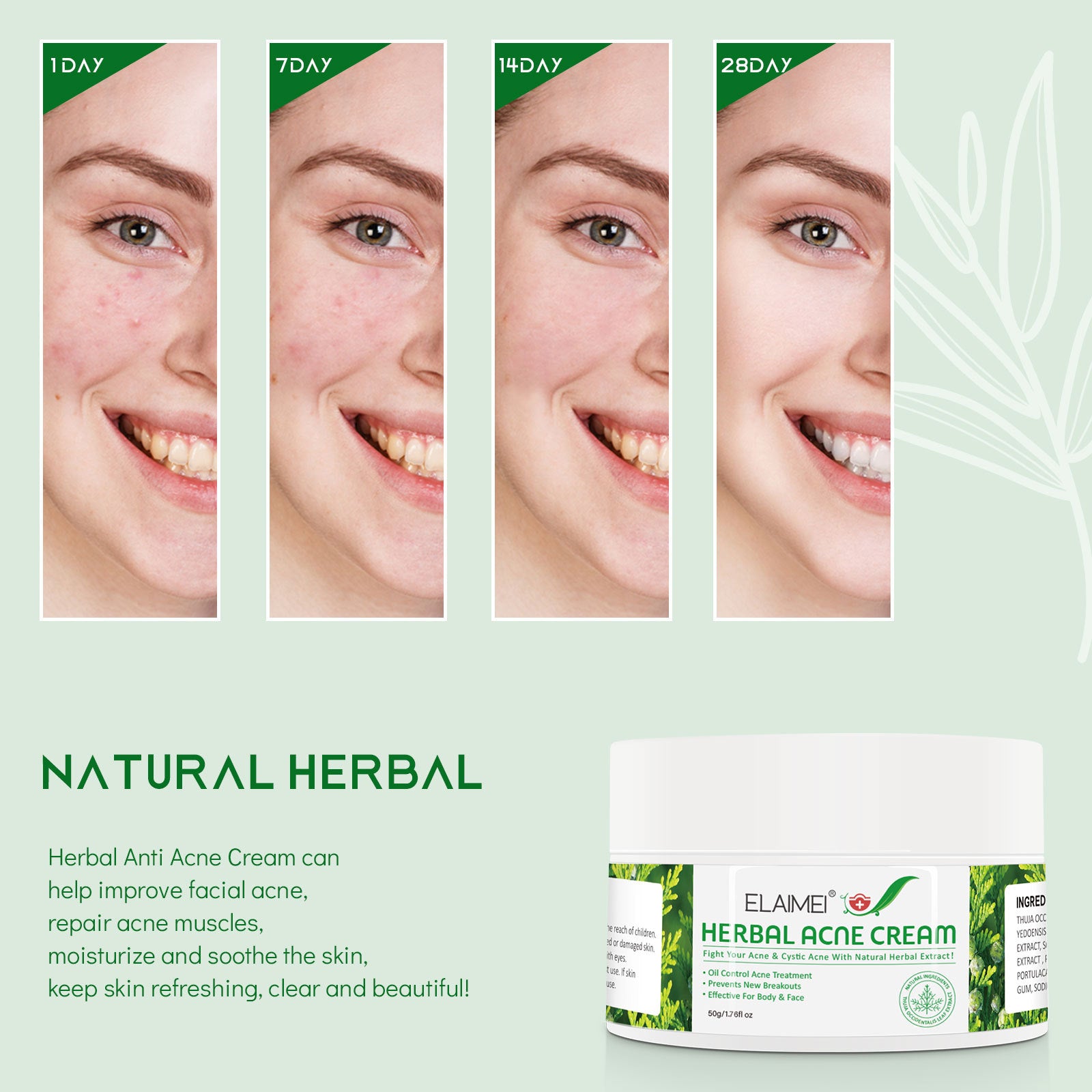 ELAIMEI Herbal Acne Treatment Cream, 50g