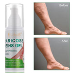 ELBBUB Varicose Viens Gel, 100ml