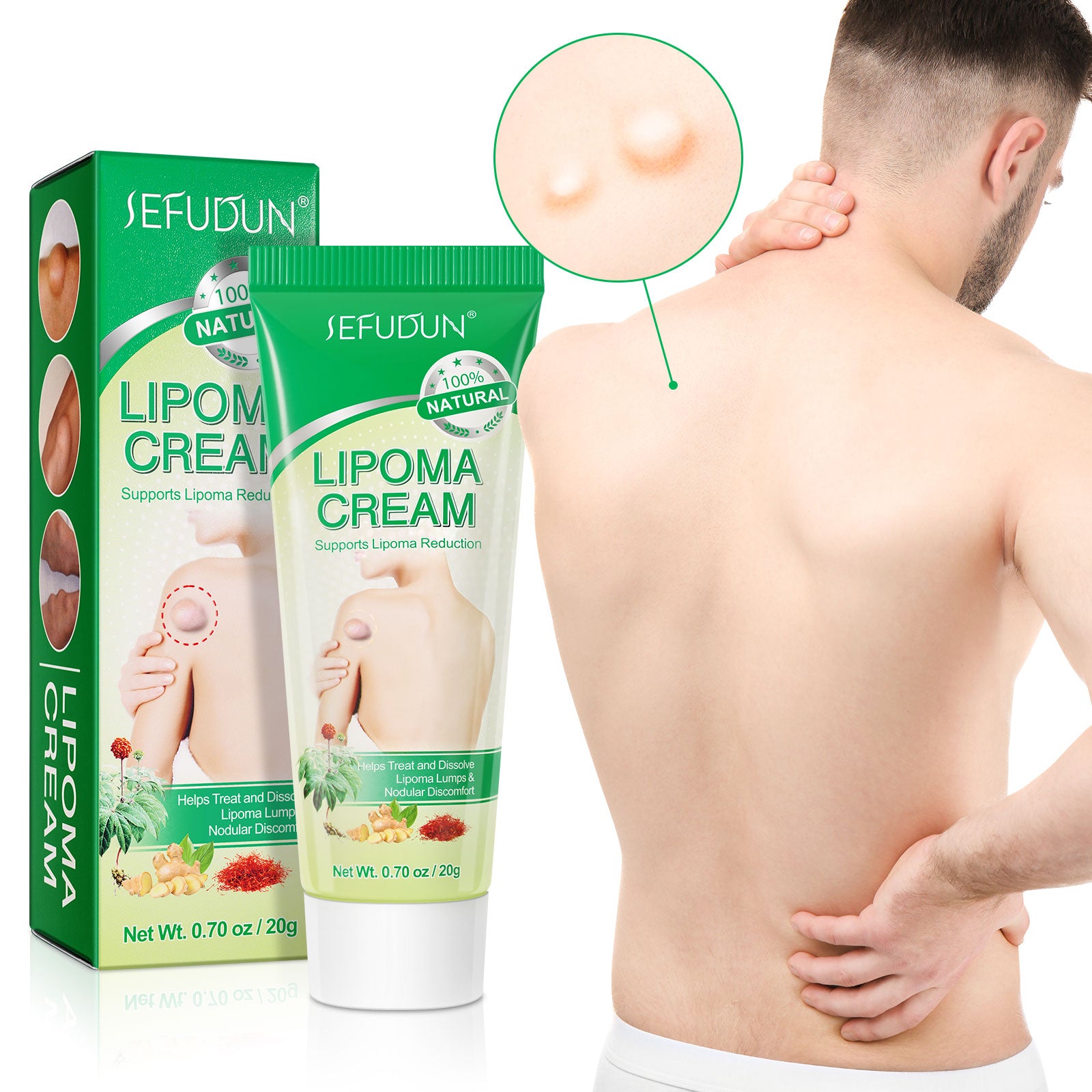 SEFUDUN Lipoma Removal Cream, 20g