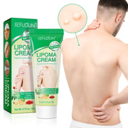 SEFUDUN Lipoma Removal Cream, 20g