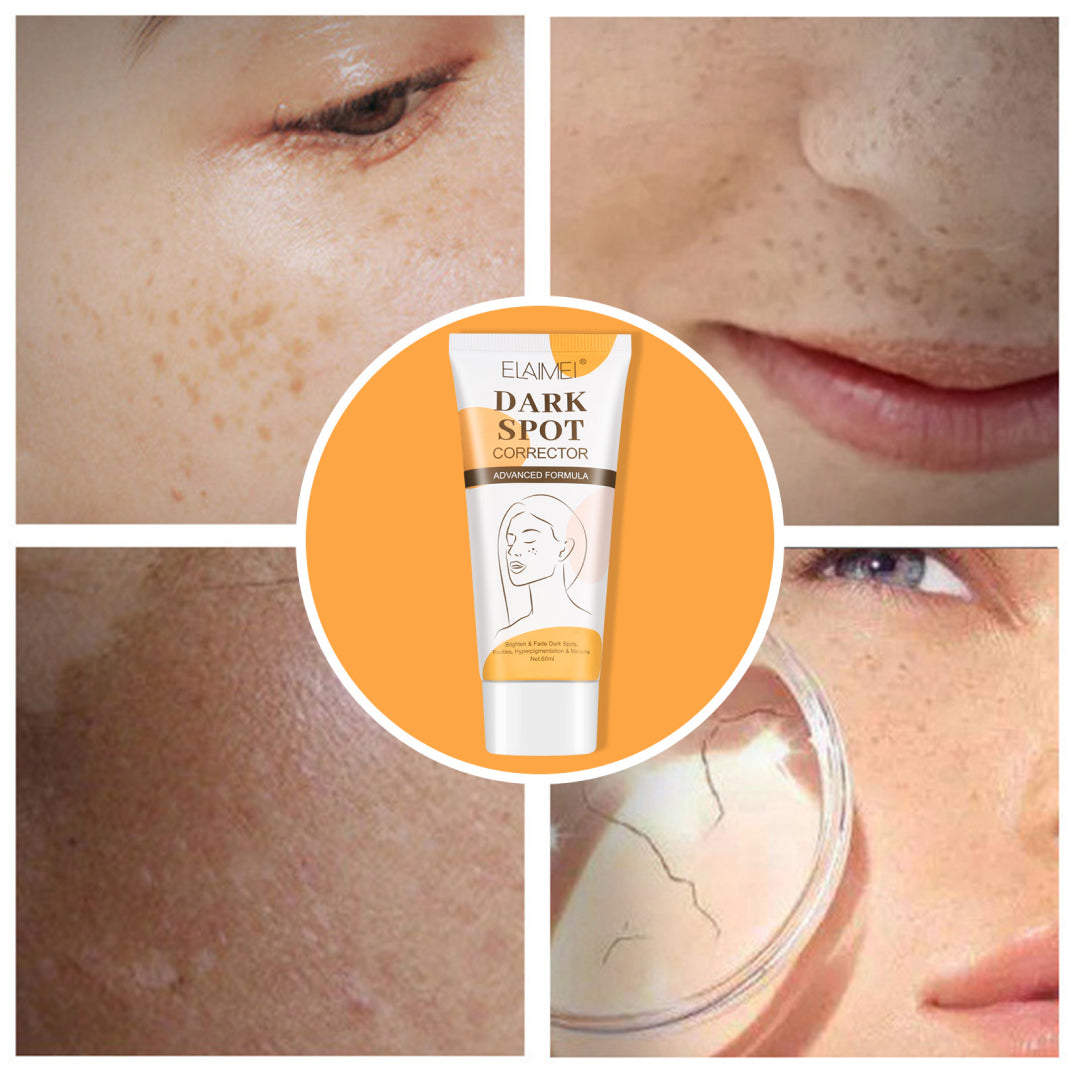 ELAIMEI Dark Spot Corrector, Whitening Skin Cream 60ml