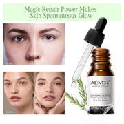 ALIVER Lactobionic Acid Face Serum, 10ml