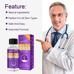 ALIVER Safe Skin Tag Removal Liquid, 30ml