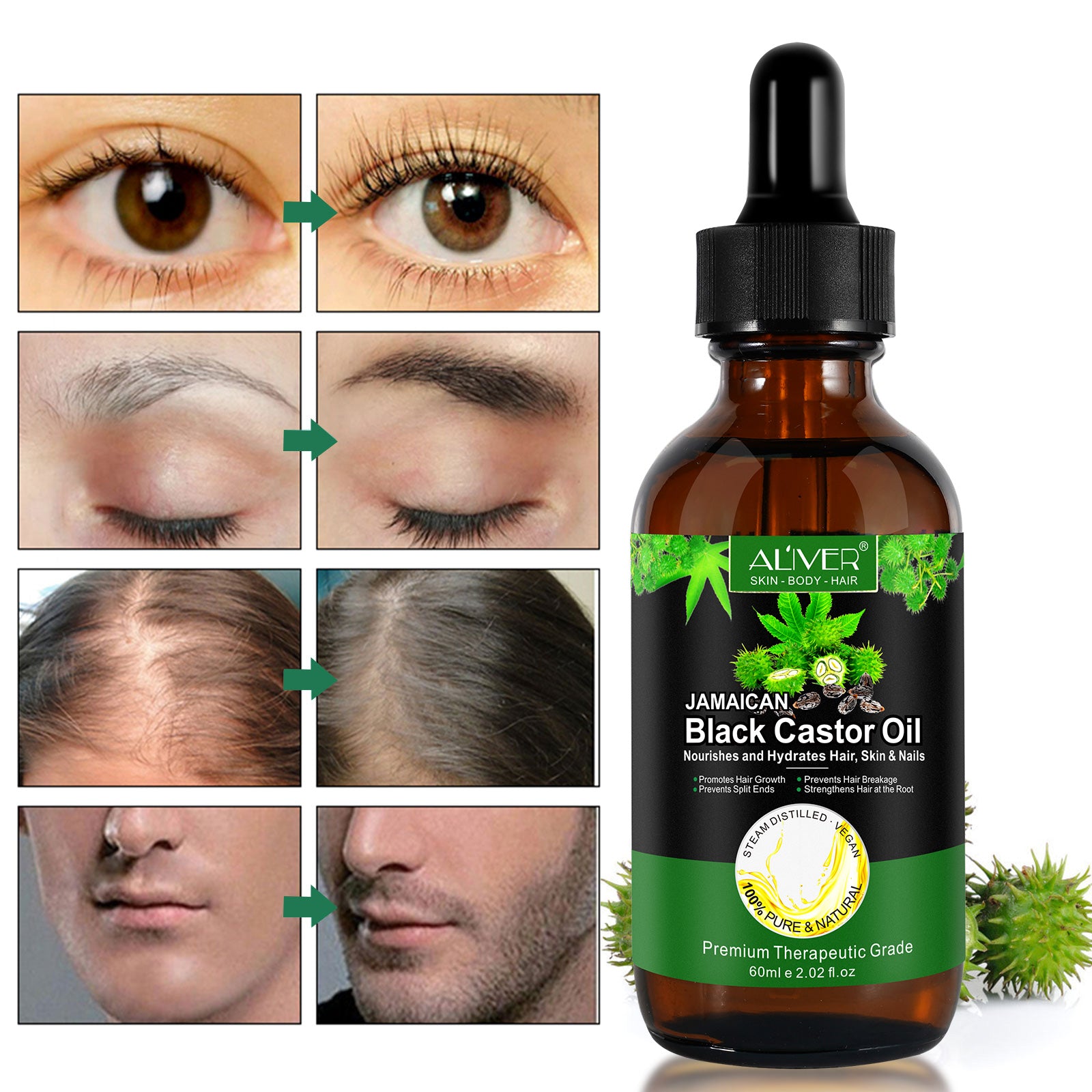 ALIVER Jamaican Black Castor Oil for Hair Growth, 60ml