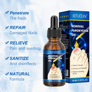 SEFUDUN Removal Paronychia Oil, 30ml