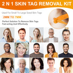 ALIVER Orange Skin Tag Remover Kit