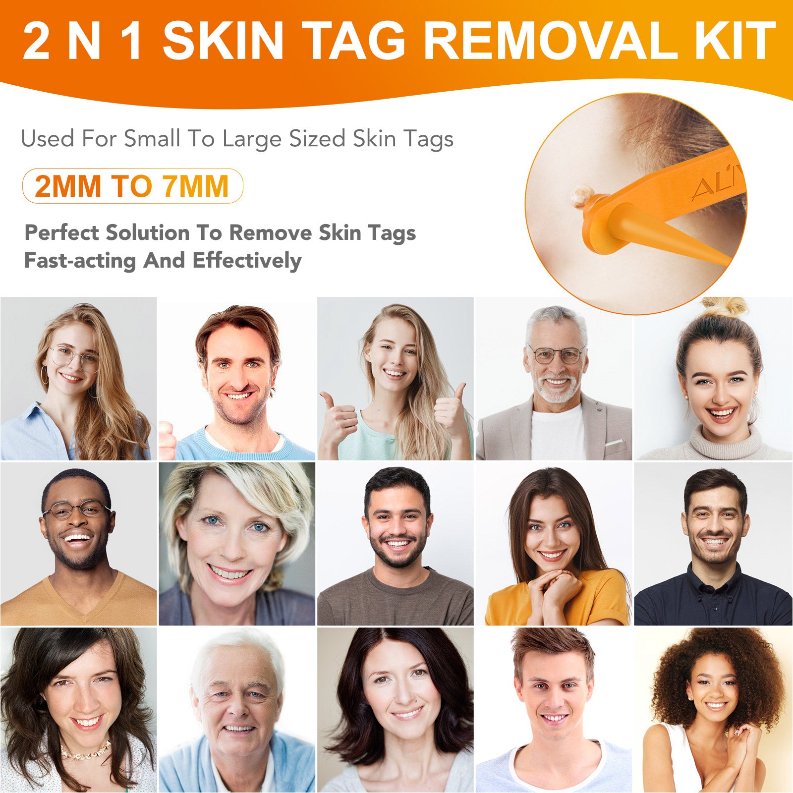 ALIVER Orange Skin Tag Remover Kit