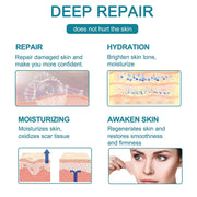 Elaimei Silicone Gel Sheet Roll for Scar Removal Treatment Tape 1.5M