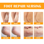ELAIMEI Orange Foot Peel Spray Oil, 100ml