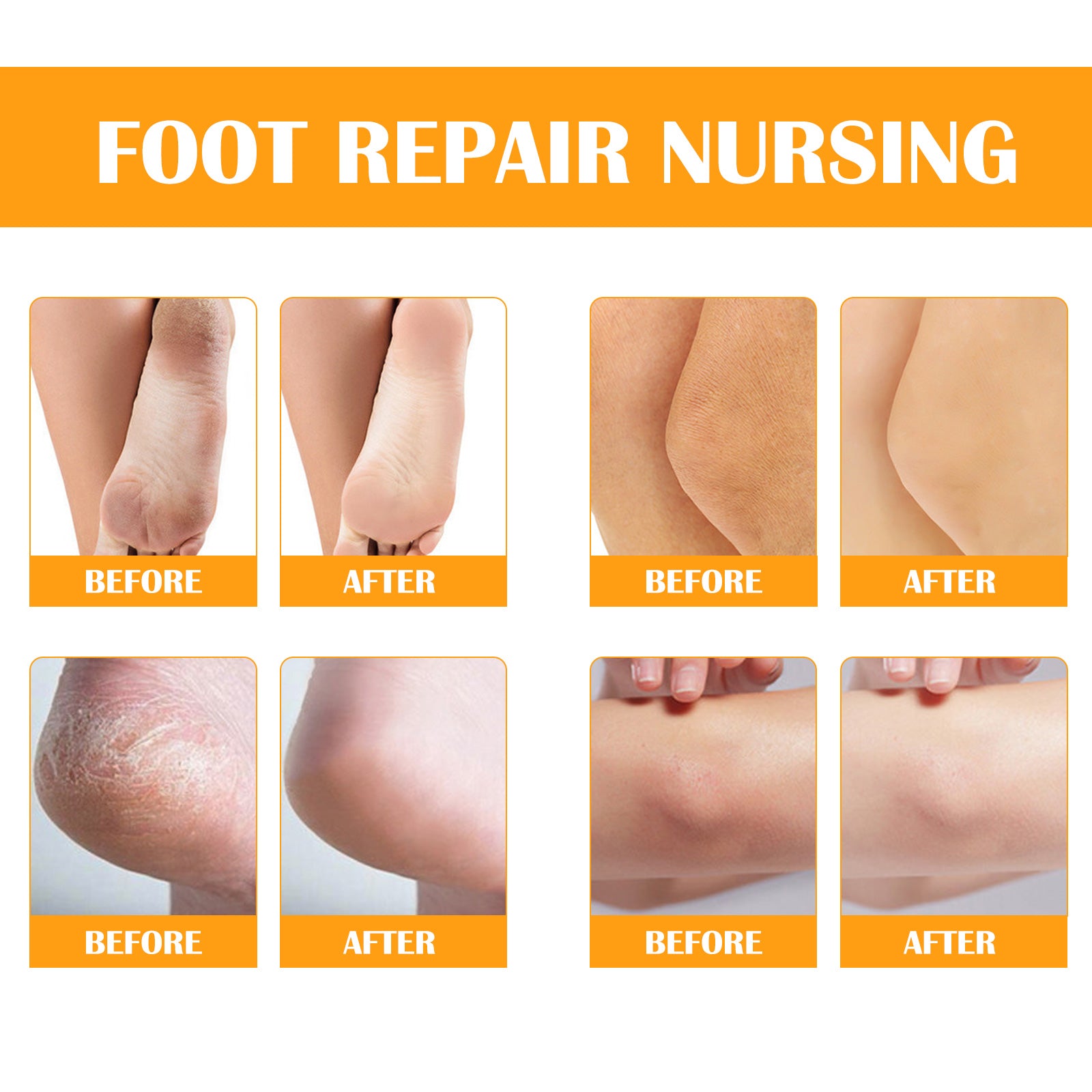 ELAIMEI Orange Foot Peel Spray Oil, 100ml