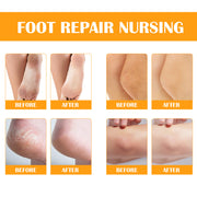 ELAIMEI Orange Foot Peel Spray Oil, 100ml