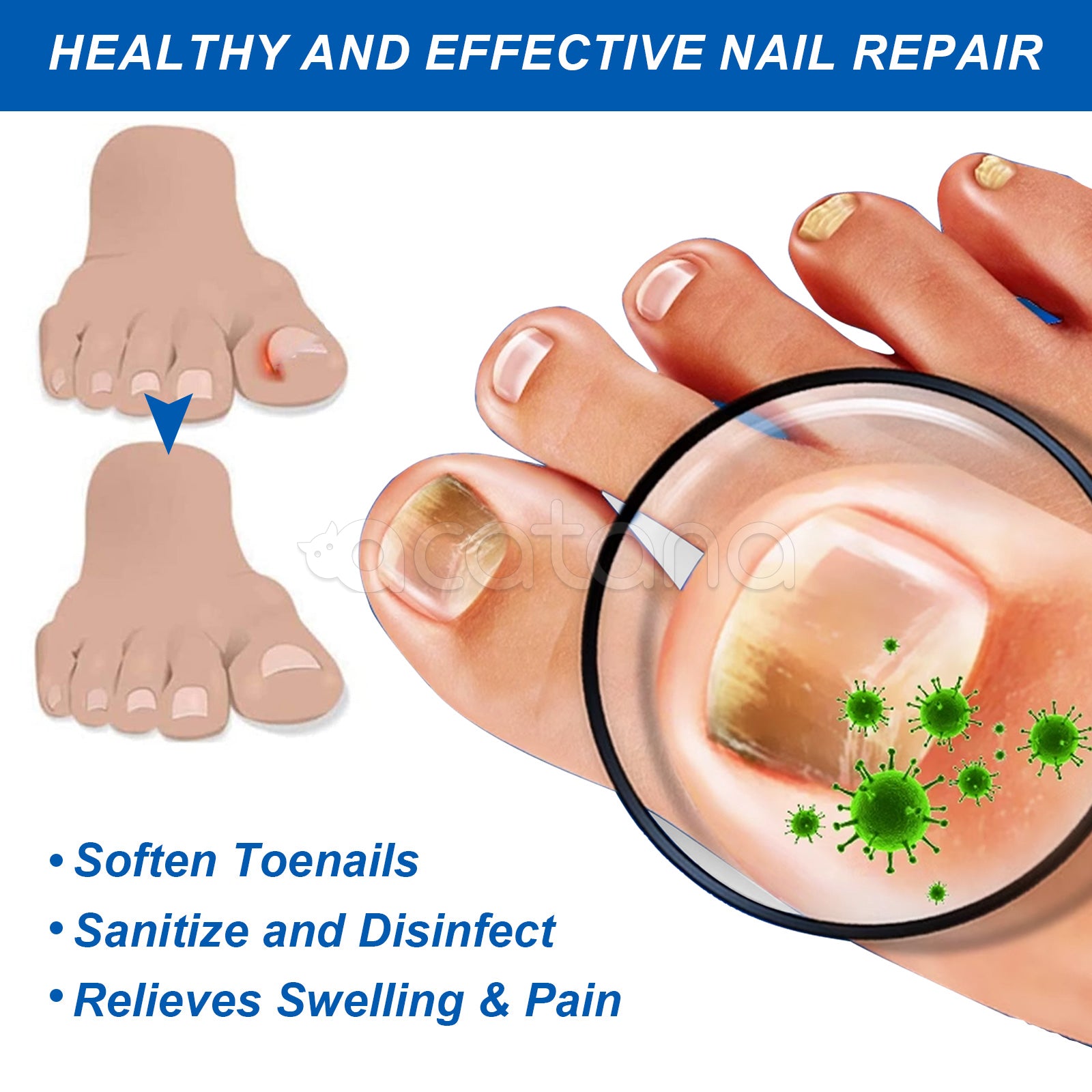 SEFUDUN Removal Paronychia Oil, 30ml