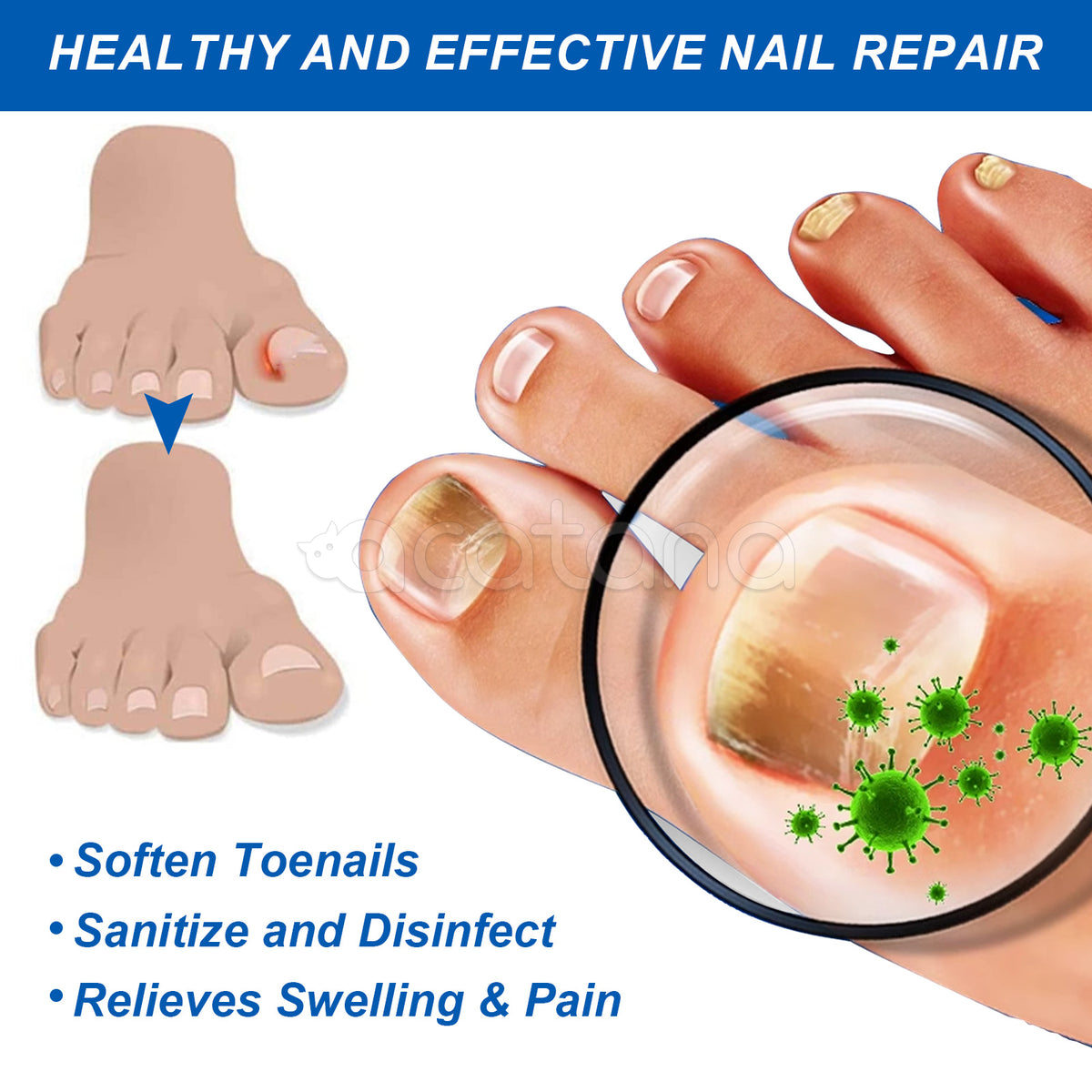 SEFUDUN Removal Paronychia Oil, 30ml