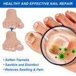 SEFUDUN Removal Paronychia Oil, 30ml