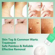 ELAIMEI Natural Skin Tag & Wart Remover Cream, 20g
