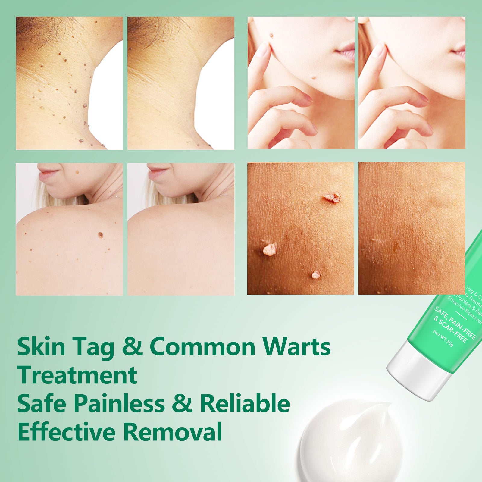 ELAIMEI Natural Skin Tag & Wart Remover Cream, 20g