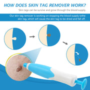 ALIVER 2in1 Gentle Skin Tag Removal Kit