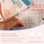 SEFUDUN Skin Tag & Acne Removal Patches, pack of 108pcs
