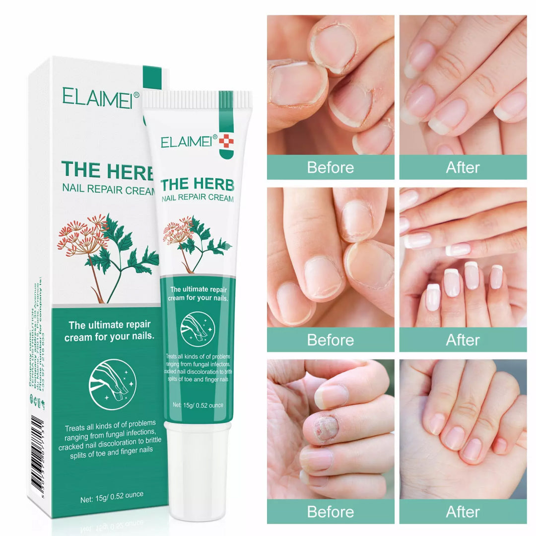 ELAIMEI Herbal Nail Repair Cream, 15g