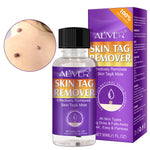 ALIVER Safe Skin Tag Removal Liquid, 30ml