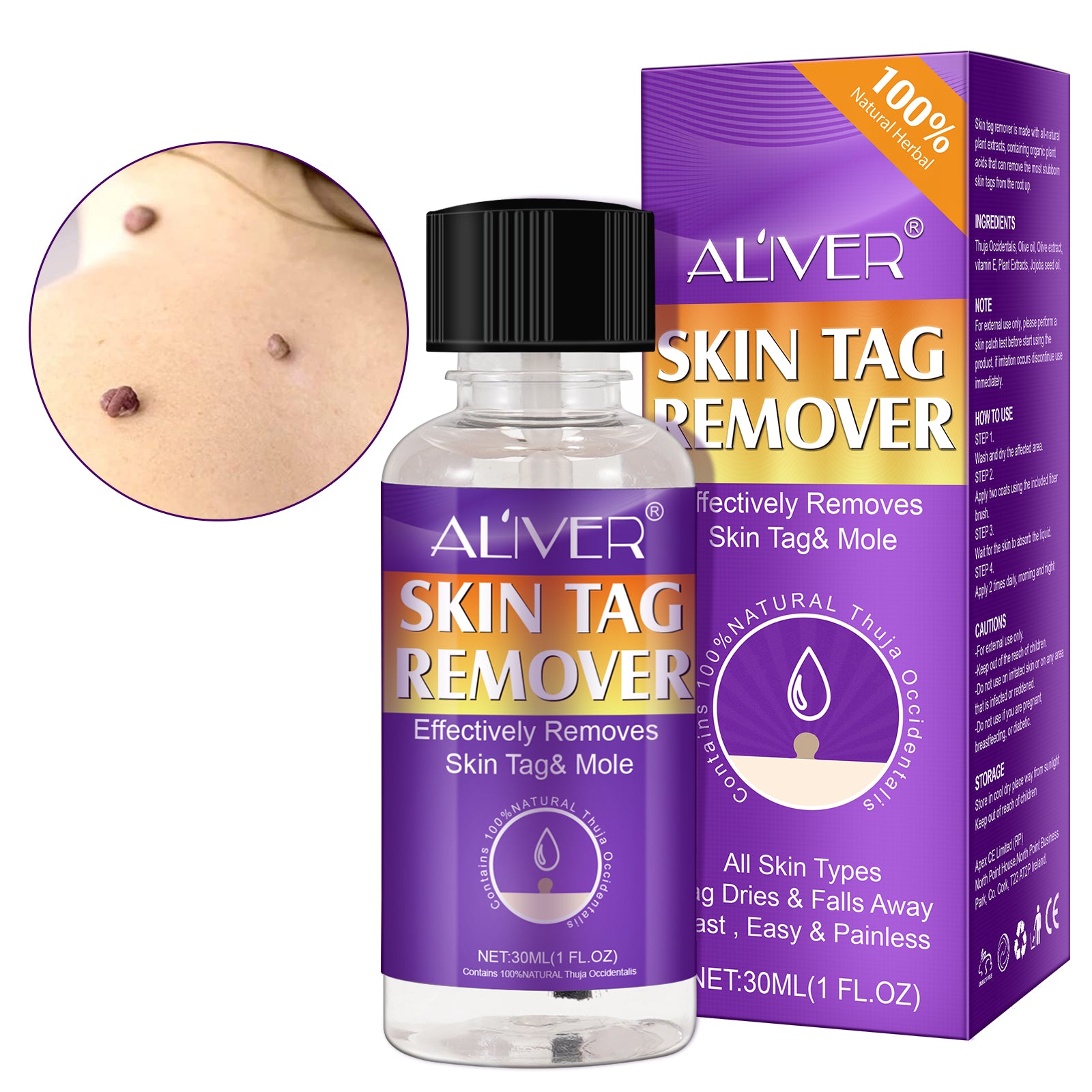 ALIVER Safe Skin Tag Removal Liquid, 30ml