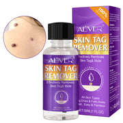 ALIVER Safe Skin Tag Removal Liquid, 30ml