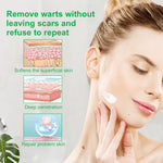 ALIVER Body Skin Tag & Wart Remover Ointment, 20g