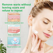 ALIVER Body Skin Tag & Wart Remover Ointment, 20g