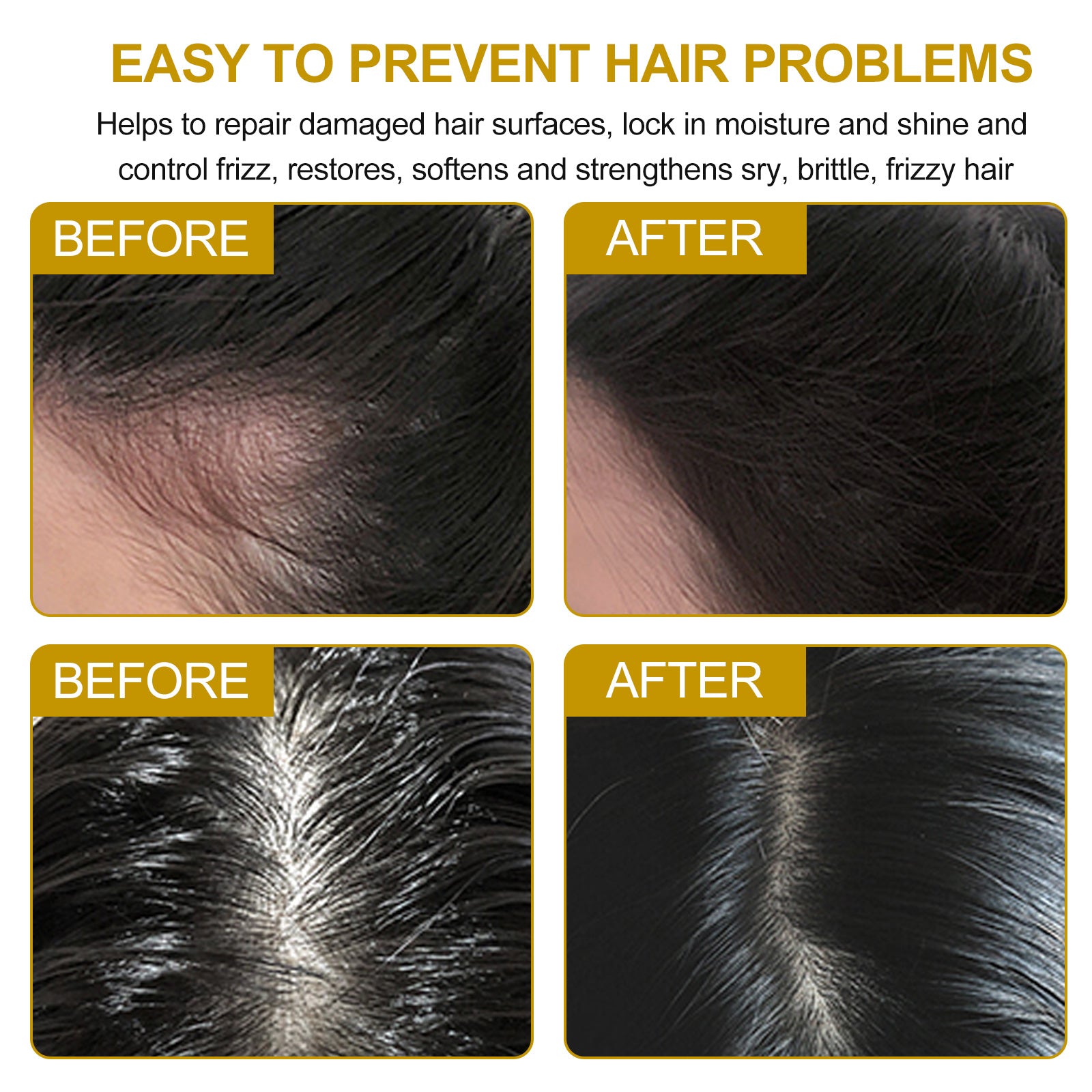 ALIVER Organic Ginger Shampoo Bar for Hair Growth, 60g